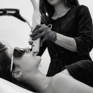 Clarity II Hair Removal